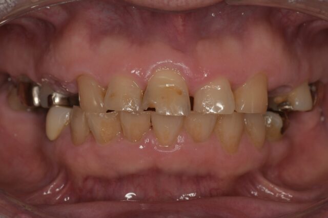 BEFORE